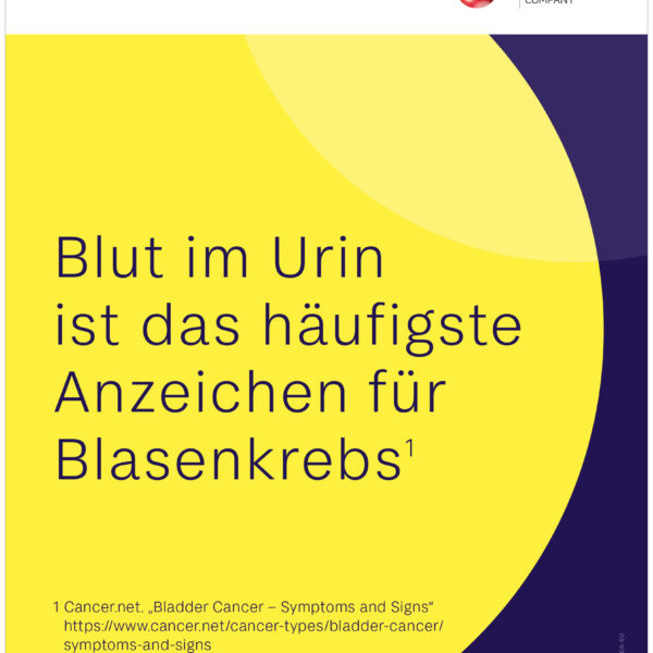 Blut im Urin ist das häufigste Anzeichen für Blasenkrebs