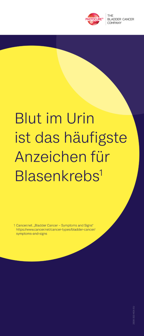 Blut im Urin ist das häufigste Anzeichen für Blasenkrebs