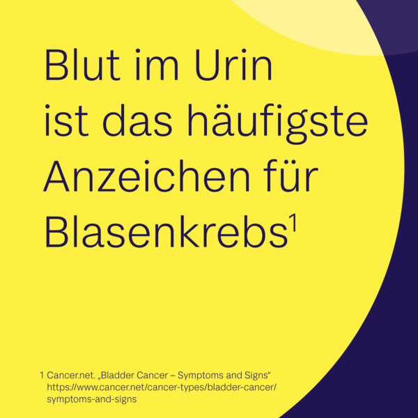 Blut im Urin ist das häufigste Anzeichen für Blasenkrebs